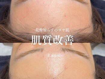 ラティエ(Latier)/ツヤ肌/乾燥ケア