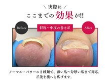 巻き爪専門店naillab.大分院の雰囲気（落ち着いた空間で施術◎巻爪,陥入爪,深爪,割れ爪なら当店へ!）