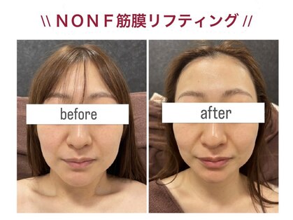 ブランシェ 富山店 × 椿の写真