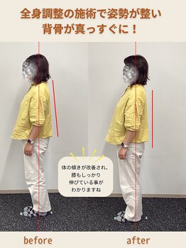 整体サロン Preava/姿勢の変化