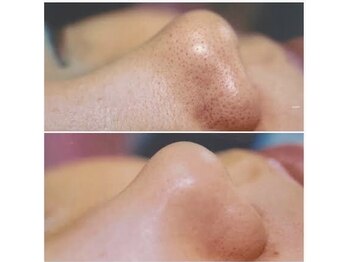 トータルビューティー シーズン(TOTAL BEAUTY Season.)/驚きの手触り