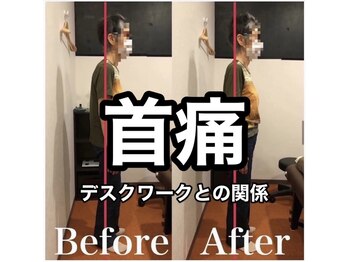 カワル整体 上通り院/首痛、デスクワークとの関係