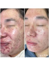 ラブリボン/短期プログラム