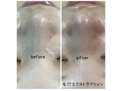 プルナモ(Purnama)の写真