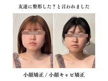 アンジェリオーラ(angeli aura)の雰囲気（【小顔矯正】たるみやシワのお悩みの方も筋膜リリースで改善！）