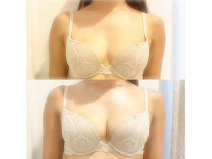 ミシェル(Michelle)の写真