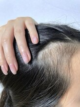 ミレマユメイク(mire)/血行促進で頭皮環境改善