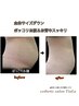 【盛岡 痩身】 お腹腰肉太もも 集中ケア40分×3回《ご予約はお早めに》