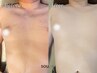 【胸・お腹全体脱毛¥11000→¥5500】胸毛/乳輪/ギャランドゥーをスッキリ◎