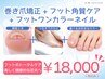 【巻き爪矯正+ワンカラー+角質付】巻き爪ケアしながらフットネイル♪￥18,000