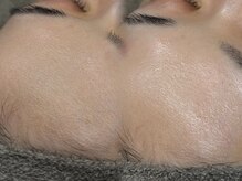 マリーメリー(marie merry)の雰囲気（【フェイスWAX】施術回数：1回つるんとツヤ肌へ◎透明感アップ!）