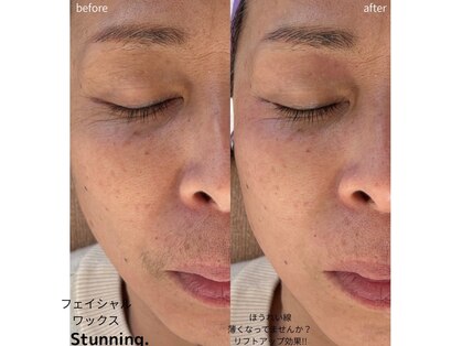 スタニング(Stunning.)の写真