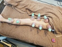 サロンハル(salon HARU)/吸い玉