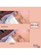 ブリリアン/ハリウッドブロウリフト　HBL