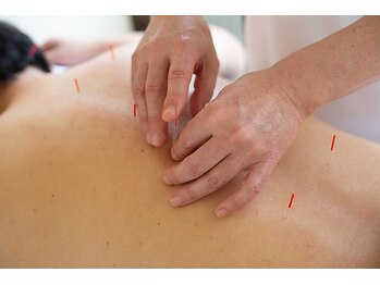 銀座マロニエ通り治療院/鍼灸は、痛みが少ない優しい鍼