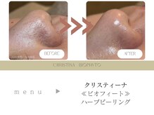 アトリエ デザイン ビューティー(atelier design beauty)の雰囲気（自然由来のハーブピーリングで毛穴引き締めニキビを抑制）