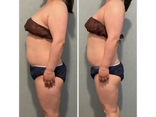 サルサナ(Salu Sana)/深部温熱リンパ痩身×全身