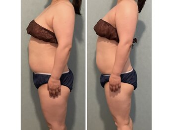 サルサナ(Salu Sana)/深部温熱リンパ痩身×全身