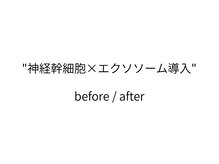 トモニ(TOMONI)/神経幹細胞×エクソソーム導入