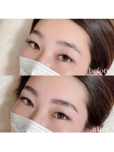 ダリ(Dali)/ハリウッドブロウリフト