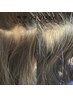 ノアグロウ　スカルプケア