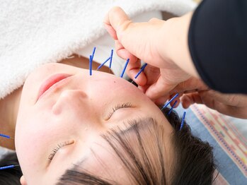 佐藤鍼灸院 美顔鍼プレム(美顔鍼PUREMU)/顔の施術4