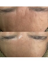 アディ(Adiy)/ビフォーアフター