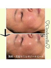 3:顧客様大人気【ターンオーバー】の最大の秘訣～年を重ね増える肌悩みが年を重ねるたび綺麗になる肌へ～