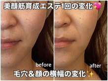 リエル(RIEL)/小顔矯正×美顔筋育成エステ