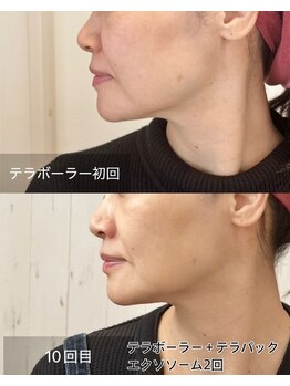 ルビーミー(Ruby's Me)/