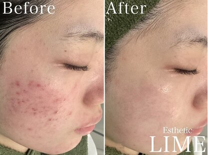 ライム 梅田(LIME)の写真