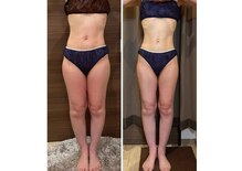 エステサロン 美飾り イオンモール木更津店