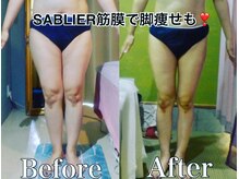 サブリエ(SABLIER)