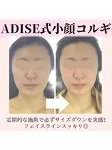 アディス 心斎橋店(ADISE)/定期的な施術で必ず変わる！