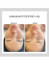 ポムハヌル 大阪梅田中崎町(pom.haneul)/韓国肌管理室