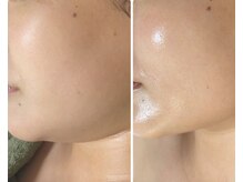 マロニャ(Maronya)の雰囲気（小顔マッサージでフェイスラインスッキリ！）