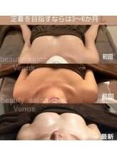 ヴィーナス(Venus)/バストアップ（痩身効果◎整体◎