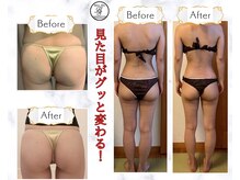 痩身ダイエットに♪ブライダルにもスリムに