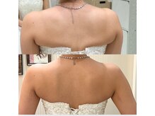 サロンドエムジョリー 横浜(Salon de M jolie)/見た目実感！背中と脇のハミ肉に