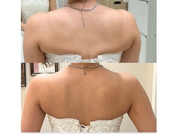 サロンドエムジョリー 横浜(Salon de M jolie)/見た目実感!背中と脇のハミ肉に