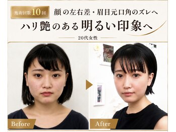 サロンチオリ 烏丸(Salon Chiori)の写真/写真で気付く眉・目・口角・輪郭の左右差。顔だけでなく、身体のゆがみから整える小顔矯正