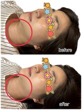 ピエール ナリタイラボ 久留米店(Piel NARITAI LABO)/小顔整体