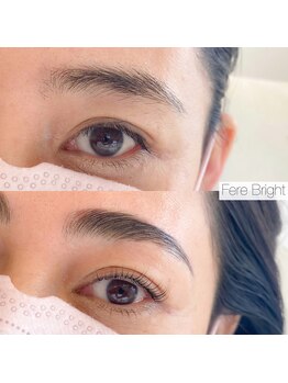 フェアブライト 宜野湾店(FereBright)/ブライトアップリフト