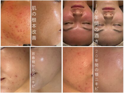 サロン ベビーフェイス(SALON BABY FACE)の写真