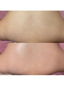 エス(S)/30代背中