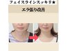 【エラ張り改善小顔】凝り固まった筋肉を緩めスッキリしたフェイスラインへ♪