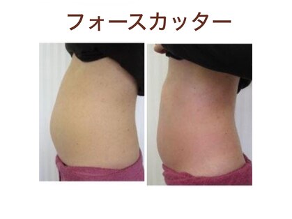 リノ(Lino)の写真