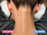 【うなじ美人！仕上がり長持ち】うなじワックス+光脱毛