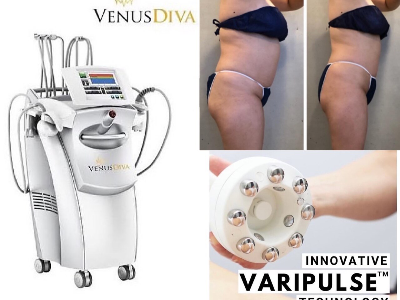 エクセレントビューティーサロン 艶(EN)｜ホットペッパービューティー