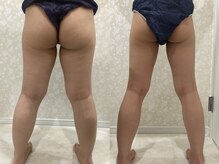 ディオーネ(Dione)/足ほっそり♪お尻も小さく♪